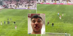 Turkse hooligan bestormt veld en breekt neus Fiorentina-middenvelder